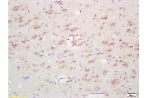 Formalin-fixed and paraffin embedded rat brain labeled with Rabbit Anti Ninein/GSK3B interacting protein Polyclonal Antibody, Unconjugated (ABIN872552) at 1:200 followed by conjugation to the secondary antibody and DAB staining (GSKIP anticorps  (AA 133-230))