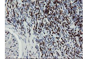 Image no. 10 for anti-GTPase, IMAP Family Member 4 (GIMAP4) antibody (ABIN1498460)