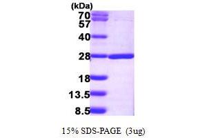 SDS-PAGE (SDS) image for Nudix (Nucleoside Diphosphate Linked Moiety X)-Type Motif 16-Like 1 (NUDT16L1) (AA 1-211) protein (His tag) (ABIN667880)