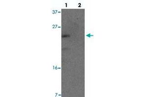 Western blot analysis of YPEL1 in HeLa cell lysate with YPEL1 polyclonal antibody  at 1 ug/mL in (lane 1) the absence and (lane 2) the presence of blocking peptide. (YPEL1 anticorps  (N-Term))