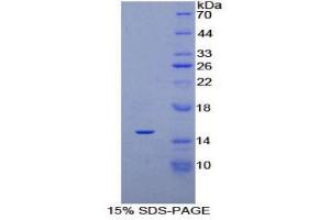 SDS-PAGE (SDS) image for PDGF-AA Homodimer (AA 90-190) protein (His tag) (ABIN1880063) (PDGF-AA Homodimer (AA 90-190) protein (His tag))