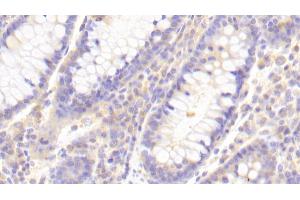 Detection of TLR8 in Human Colon Tissue using Polyclonal Antibody to Toll Like Receptor 8 (TLR8)