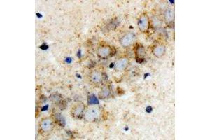 Immunohistochemical analysis of HARS2 staining in rat brain formalin fixed paraffin embedded tissue section. (HARS2 anticorps)