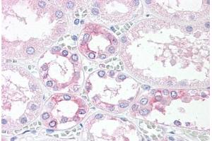 Anti-TM9SF4 antibody  ABIN1049415 IHC staining of human, kidney. (TM9SF4 anticorps  (Internal Region))