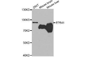 Western Blotting (WB) image for anti-Erythrocyte Membrane Protein Band 4.1 (Elliptocytosis 1, RH-Linked) (EPB41) antibody (ABIN1872554) (EPB41 anticorps)