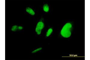 Immunofluorescence of monoclonal antibody to TCEA3 on HepG2 cell.