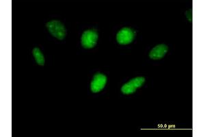Immunofluorescence of purified MaxPab antibody to USF1 on HeLa cell.