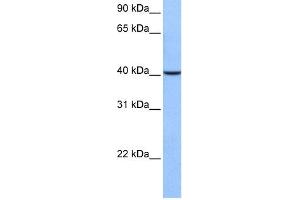 WB Suggested Anti-AGBL5 Antibody Titration: 0. (AGBL5 anticorps  (C-Term))