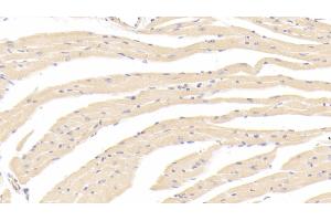 Detection of OPG in Mouse Heart Tissue using Polyclonal Antibody to Osteoprotegerin (OPG)