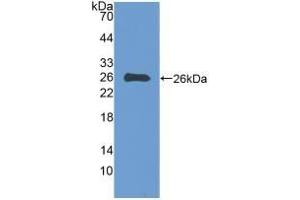 Detection of Recombinant EBI3, Human using Polyclonal Antibody to Epstein Barr Virus Induced Protein 3 (EBI3) (EBI3 anticorps  (AA 21-229))