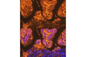 Immunofluorescence analysis of mouse intestin using FABPI Rabbit mAb (ABIN7267151) at dilution of 1:100 (40x lens).