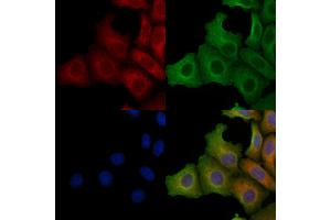 ABIN6259189 and ABIN6275241 staining Hela cells by IF/ICC.