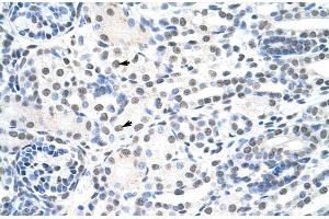 Rabbit Anti-THOC1 Antibody  Paraffin Embedded Tissue: Human Kidney Cellular Data: Epithelial cells of renal tubule Antibody Concentration: 4. (THOC1 anticorps  (C-Term))