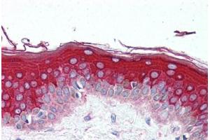 Human Skin (formalin-fixed, paraffin-embedded) stained with GBL antibody ABIN297122 at 10 ug/ml followed by biotinylated goat anti-rabbit IgG secondary antibody ABIN481713, alkaline phosphatase-streptavidin and chromogen. (GBL anticorps  (AA 150-200))