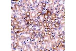 Immunohistochemistry (IHC) image for anti-Nephrosis 1, Congenital, Finnish Type (Nephrin) (NPHS1) (C-Term) antibody (ABIN1030538) (Nephrin anticorps  (C-Term))