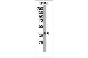 Western Blotting (WB) image for anti-EPH Receptor A5 (EPHA5) antibody (ABIN356398) (EPH Receptor A5 anticorps)