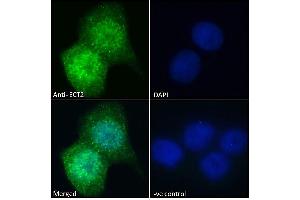 (ABIN185018) Immunofluorescence analysis of paraformaldehyde fixed A431 cells, permeabilized with 0. (ECT2 anticorps  (N-Term))