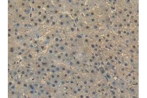 Detection of HSPA1A in Human Liver Tissue using Polyclonal Antibody to Heat Shock 70 kDa Protein 1A (HSPA1A)