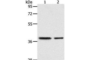 Western Blot analysis of Human fetal kidney and fetal muscle tissue using CNN3 Polyclonal Antibody at dilution of 1:400 (CNN3 anticorps)
