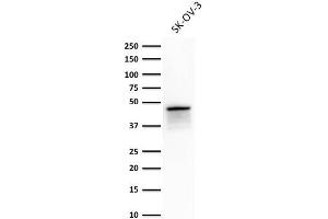 Western Blot Analysis of SK-OV-3 cell lysate using Cytokeratin 8 Monoclonal Antibody (TS1).