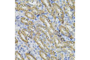 Immunohistochemistry of paraffin-embedded mouse kidney using SPTLC1 Antibody (ABIN5974083) at dilution of 1/100 (40x lens). (SPTLC1 anticorps)