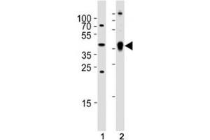 Western blot analysis of (1) zebrafish brain and (2) whole zebrafish tissue lysate using Ada antibody. (ADA anticorps  (AA 114-148))