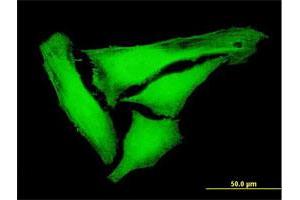 Immunofluorescence of purified MaxPab antibody to KIFC3 on HeLa cell.