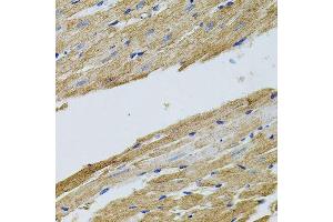 Immunohistochemistry of paraffin-embedded rat heart using TRMT2A antibody. (TRMT2A anticorps  (C-Term))