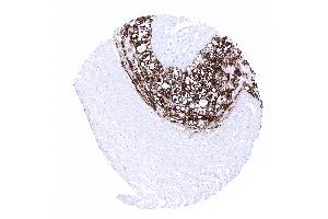 placenta mature amnion and chorion