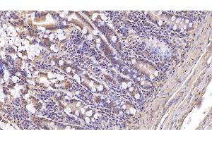 Detection of ASPH in Human Small intestine Tissue using Monoclonal Antibody to Aspartate Beta Hydroxylase (ASPH)