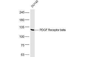 DU145 lysates probed with PDGF Receptor beta Polyclonal Antibody, Unconjugated  at 1:500 dilution and 4˚C overnight incubation. (PDGFRB anticorps  (AA 981-1066))