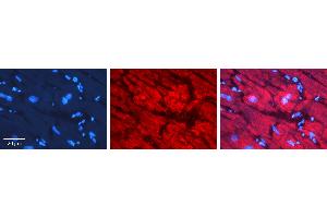 Rabbit Anti-NXF1 Antibody   Formalin Fixed Paraffin Embedded Tissue: Human heart Tissue Observed Staining: Cytoplasmic, nucleus Primary Antibody Concentration: N/A Other Working Concentrations: 1:600 Secondary Antibody: Donkey anti-Rabbit-Cy3 Secondary Antibody Concentration: 1:200 Magnification: 20X Exposure Time: 0. (NXF1 anticorps  (N-Term))