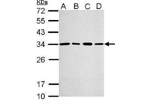 WB Image Sample (30 ug of whole cell lysate) A: A549 B: H1299 C: HCT116 D: MCF-7 12% SDS PAGE antibody diluted at 1:2000 (PSME3 anticorps)