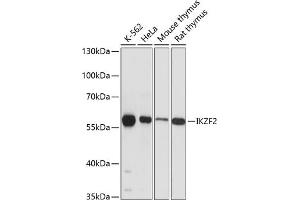 Western blot analysis of extracts of various cell lines, using IKZF2 antibody (ABIN6130817, ABIN6142288, ABIN6142289 and ABIN6215874) at 1:3000 dilution. (IKZF2 anticorps  (AA 300-440))