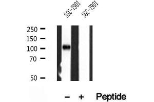 Western blot analysis of extracts of SGC-7901 cells, using PPP1R15B antibody. (PPP1R15B anticorps)