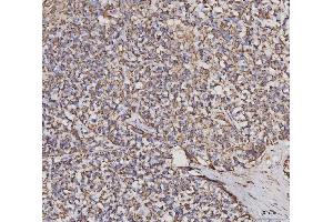 IHC analysis of MDH2 using anti-MDH2 antibody (ABIN7602617).
