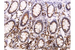 Immunoperoxidase of monoclonal antibody to BCAP29 on formalin-fixed paraffin-embedded human colon. (BCAP29 anticorps  (AA 125-241))