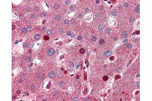 Immunohistochemistry (IHC) image for anti-Complement Component 8, beta Polypeptide (C8B) (C-Term) antibody (ABIN2781764)