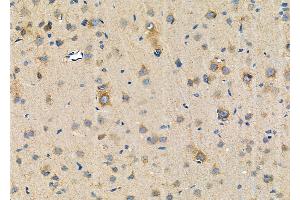 ABIN6257824 and ABIN6274609 at 1/100 staining Rat brain tissue by IHC-P.