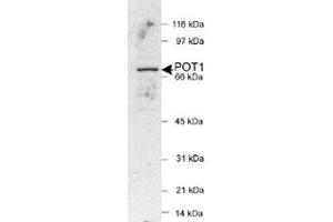 Western blot analysis of POT1 in HeLa nuclear extracts (25 ug) with POT1 polyclonal antibody . (POT1 anticorps  (AA 200-300))