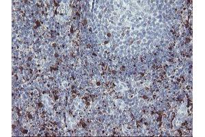 Image no. 5 for anti-Coagulation Factor XIII, A1 Polypeptide (F13A1) antibody (ABIN1498150)