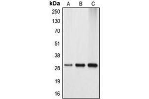Western blot analysis of APOA1BP expression in HEK293T (A), mouse kidney (B), rat kidney (C) whole cell lysates.