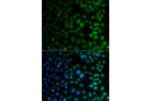 Immunofluorescence analysis of A549 cells using NAA40 antibody (ABIN4904481).