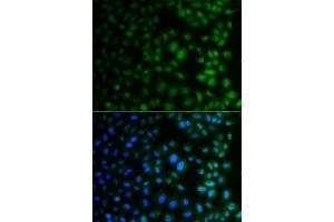 Immunofluorescence analysis of A549 cells using NAA40 antibody (ABIN4904481). (NAA40 anticorps)