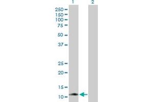 Western Blot analysis of KIR3DX1 expression in transfected 293T cell line by KIR3DX1 MaxPab polyclonal antibody. (KIR3DX1 anticorps  (AA 1-78))