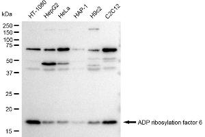 Western blotting analysis using ADP ribosylation factor 6 antibody (ABIN7797532). (Recombinant ARF6 anticorps)