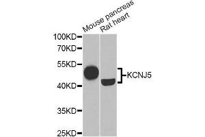 Western blot analysis of extracts of various cell lines, using KCNJ5 Antibody (ABIN5975408) at 1/1000 dilution. (KCNJ5 anticorps)