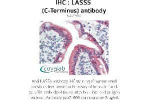 Image no. 1 for anti-LAG1 Homolog, Ceramide Synthase 5 (LASS5) (C-Term) antibody (ABIN1736366) (LASS5 anticorps  (C-Term))