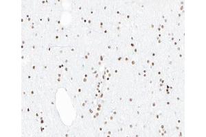 ABIN6266861 at 1/100 staining human brain tissue sections by IHC-P. (PIAS1 anticorps  (N-Term))