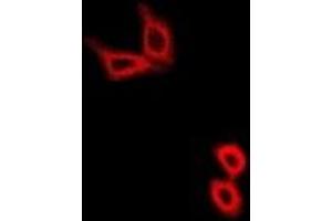 Immunofluorescent analysis of Hexokinase 2 staining in U2OS cells.